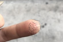 手上为什么有很多毛？（毛发的生理原因及影响）