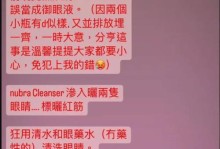 红血丝眼球的原因与意义（揭开红血丝眼球的秘密，了解其隐藏的健康信号）