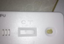 探究狗狗细小病毒的危害与预防（了解细小病毒的成因、症状及治疗方法）