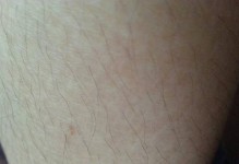狗狗流产的原因、症状与处理方法（了解狗狗流产，保护它们的健康）