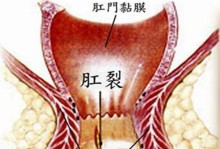 泰迪狗拉屎出血的原因及处理方法（了解泰迪狗拉屎出血的常见原因和应对方法，保护宠物健康）