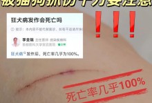 狂犬病（探究狂犬病患者的生存期限）