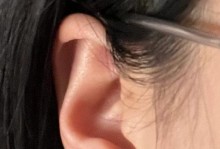 探究耳朵痒的原因及应对方法（耳朵痒的症状、原因及预防措施）