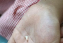狗狗的牙齿生长过程（狗狗牙齿发育顺序及护理方法）