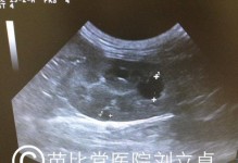 猫双肾肿大能活多久？（探寻猫咪双肾肿大的生命期限和幸福生活的关键）