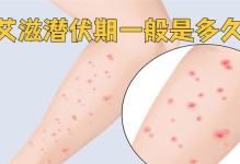 揭秘细小传染潜伏期（探寻传染潜伏期长短，关键在于细小）