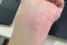 猫打了疫苗会有哪些反应？（了解猫咪接种疫苗的常见反应及应对方法）