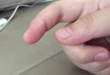 仓鼠脚肿怎么办？五个小步骤教你治好它！（从日常护理到治疗方法，关注你的宠物仓鼠的健康！）