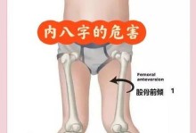 解读狗狗腿内八字的原因（了解狗狗内外八字的重要性及相关解决方法）