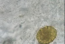 泰迪狗肚子里有虫子的症状和原因解析（了解泰迪狗肚子里有虫子的症状和原因，保护宠物健康）